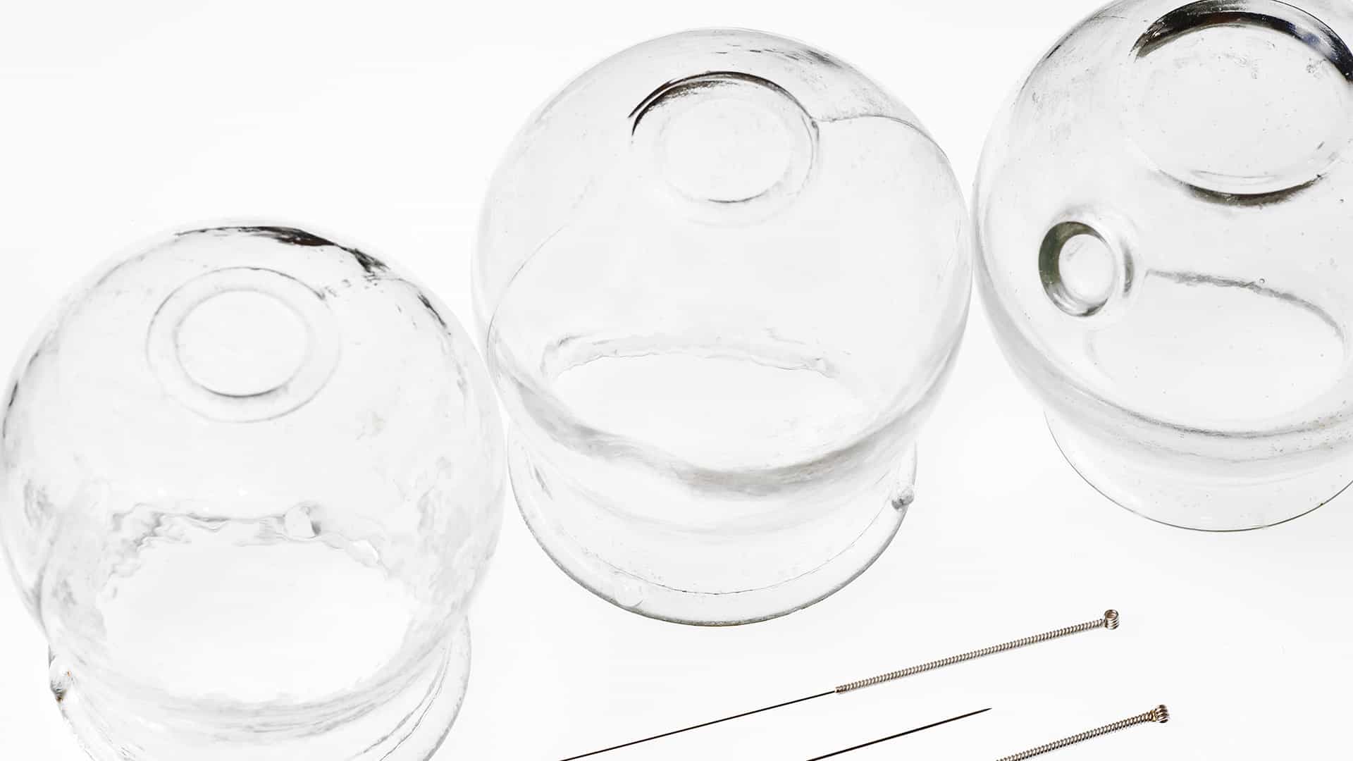acupuncture, mtc, médecine traditionnelle chinoise, ventouse, gua sha, insomnie, stress, endométriose, pma, fertilité, fiv, acné, migraine, burnout, grossesse, ventre, mal de dos, douleur, tension, allergie, eczéma, ménopause, bouffée, chaleur, sion, valais, suisse