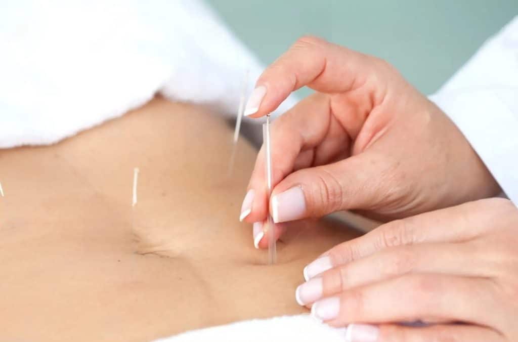 Séance d'acupuncture abdominale à Sion en Valais
